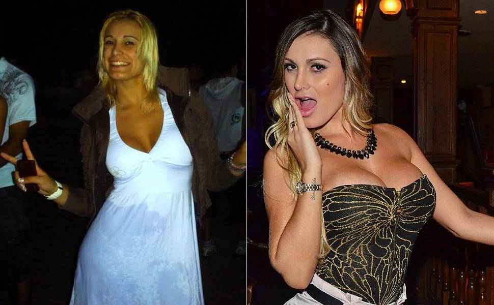 Fotos Do Antes E Depois De Andressa Urach Vazam Na Internet