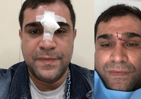 Evandro Santo, do “Melhor da Tarde”, sofre acidente doméstico
