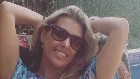 Ex-Paquita assusta seguidores ao revelar queimadura nos olhos após acidente