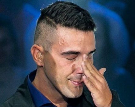 André Marques mostra antes e depois de cirurgia e faz desabafo em rede social