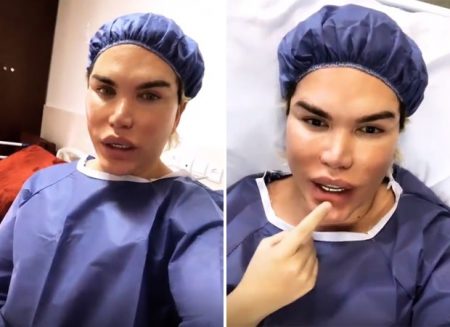 Ken Humano retorna ao Irã para fazer 64ª cirurgia plástica