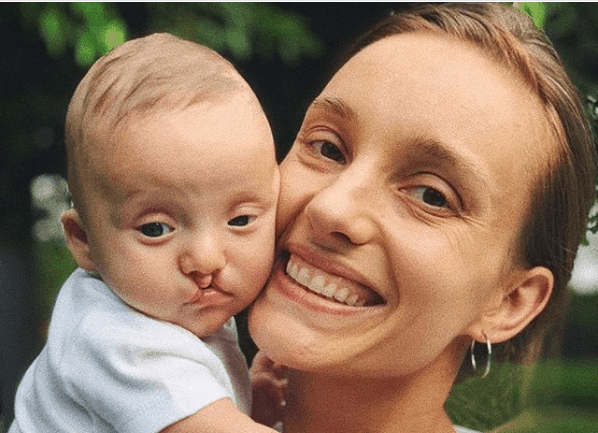 Irmã de Ana Hickmann desabafa após internauta fazer comentário ofensivo sobre filho