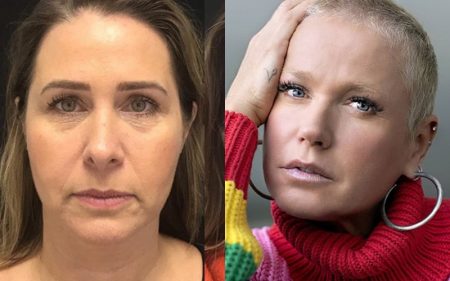 Ex-paquita segue conselho de Xuxa e toma decisão sobre harmonização
