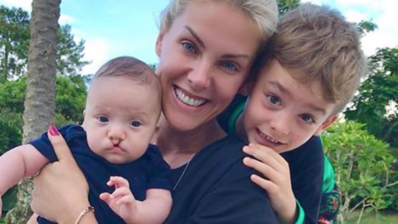 Sobrinho de Ana Hickmann passa por cirurgia para corrigir lábios
