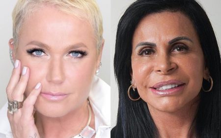 Xuxa surpreende e faz harmonização facial com cirurgião da Gretchen