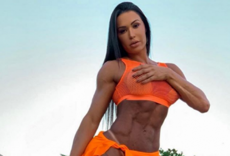 Gracyanne Barbosa causa com “procedimento estranho” no bumbum