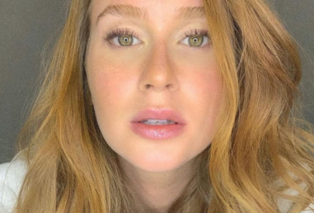 Marina Ruy Barbosa nega botox e revela herpes na boca
