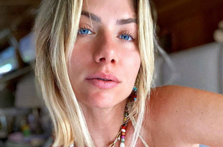 Giovanna Ewbank mostra recuperação de cadela que adotou das ruas e comove fãs