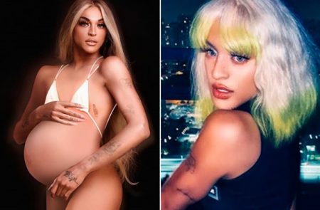 Grávida? Pabllo Vittar faz ultrassom e é chamada de “mamãe do ano”