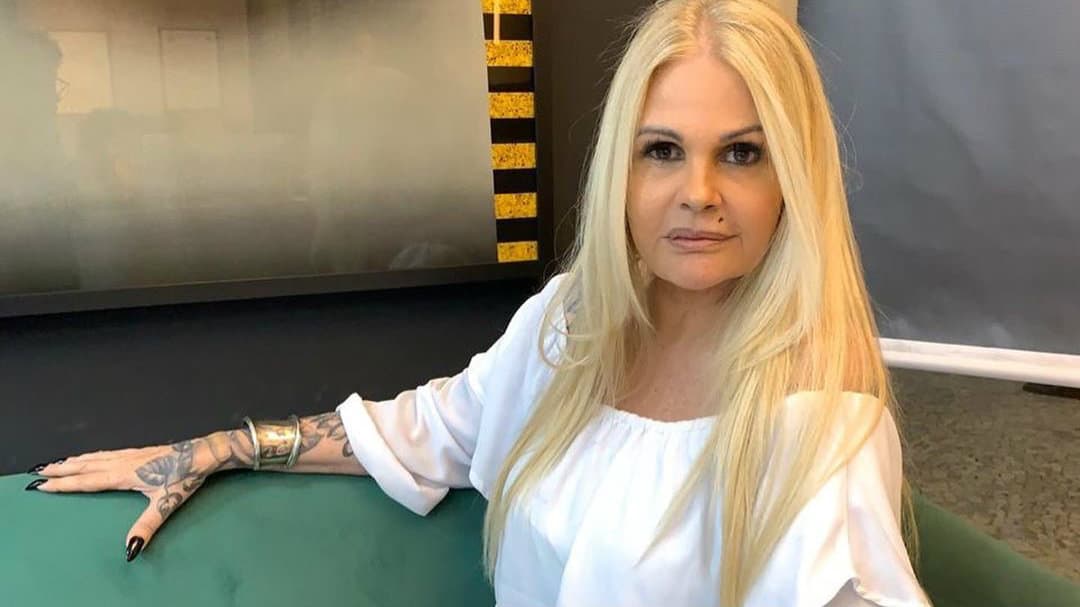 Monique Evans investe em harmonização facial e resultado surpreende