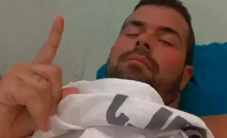 Borat exibe cicatriz no abdômen após ser baleado no Rio de Janeiro