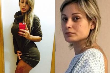 Após 8 anos, Andressa Urach faz revelação sobre polêmico hidrogel