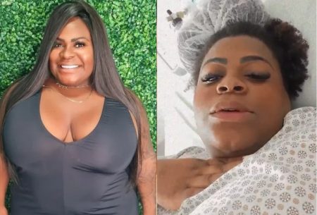 Após perder 14 kg, Jojo Todynho retira balão gástrico