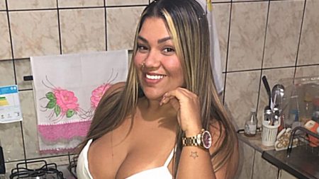 Mulher Filé mostra o pós-operatório após complicações em próteses de silicone