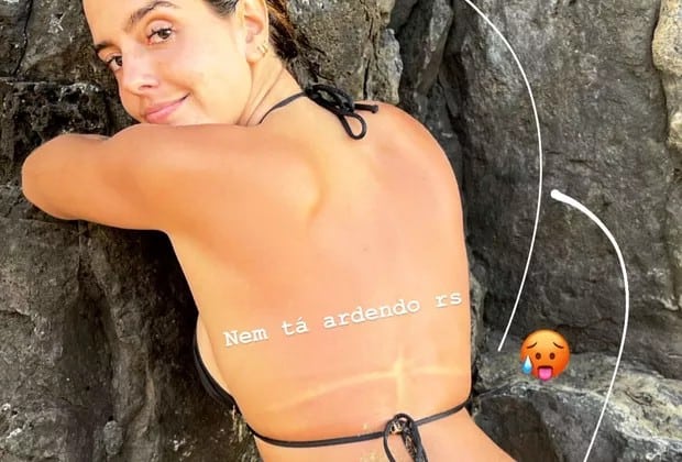 Giovanna Lancellotti exagera no sol e exibe marquinha de biquíni