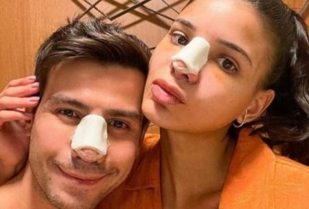 Jakelyne Oliveira explica injeções na costela após fazer rinoplastia