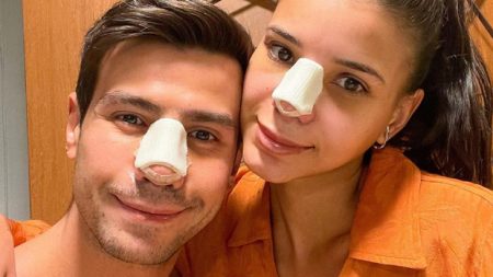Mariano e Jakelyne Oliveira mostram “antes e depois” da rinoplastia