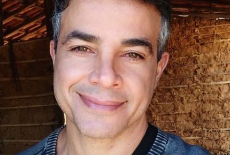 Anderson Di Rizzi passa por transplante capilar e revela resultado nas redes sociais