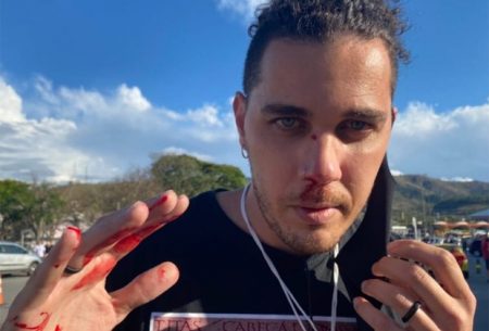 Polícia toma atitude após agressão a cinegrafista da GloboNews em Aparecida