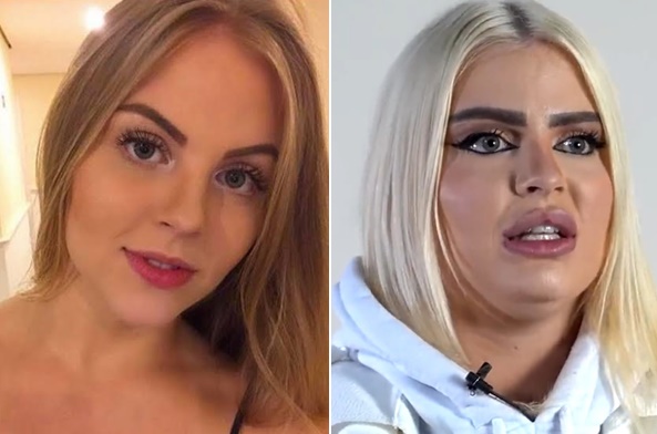 Luísa Sonza se revolta após comparação do antes e depois do seu rosto
