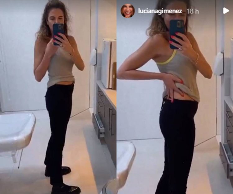 Luciana Gimenez mostra procedimento que fez no bumbum