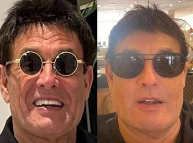 Sérgio Mallandro choca com antes e depois de harmonização facial