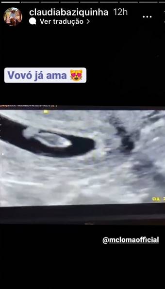 Mãe de MC Loma comenta a gravidez da filha