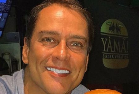 Marcello Antony passa por transplante capilar e exibe resultado