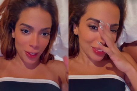 Anitta surpreende e mostra hematomas no corpo após comemorar o aniversário