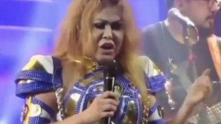 Joelma não se abala e faz piada com rosto totalmente inchado: “A cara do Quico”