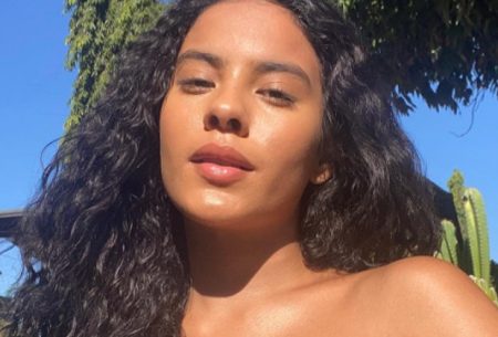 Bella Campos passa por procedimento e muda o sorriso; confira resultado