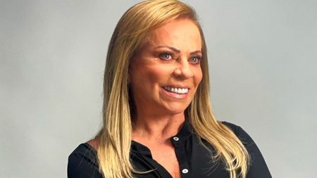 Christina Rocha impressiona ao mostrar “antes e depois” de harmonização facial