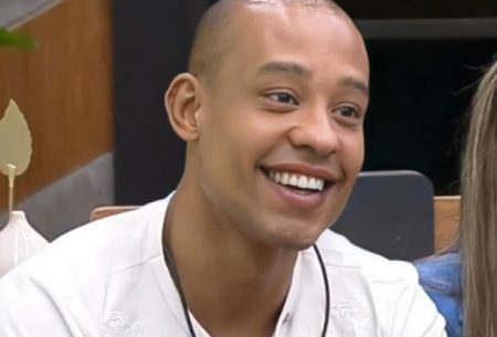Mussunzinho passa por harmonização facial e faz confissão: “Me atrapalhava”