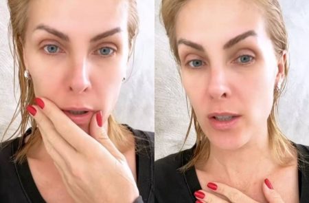 Ana Hickmann sofre acidente doméstico e se livra por pouco de situação grave