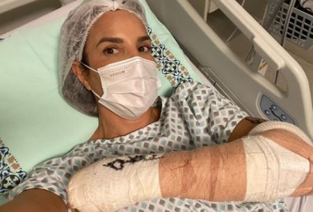 Ivete Sangalo exibe detalhes de acidente e imagens impressionam