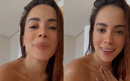 Anitta fica em choque ao acordar e ver cabelo cortado enquanto estava bêbada