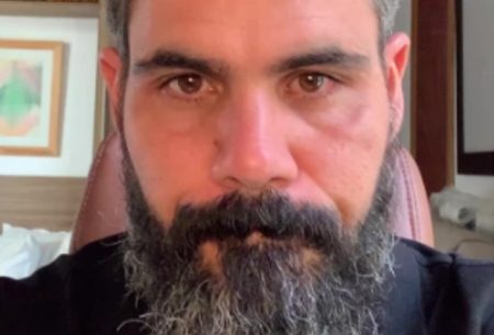 Juliano Cazarré mostra treino e celebra sucesso em terceira cirurgia da filha caçula