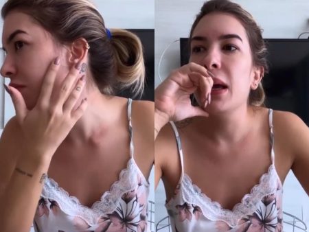 Lorena Improta revela alergia após procedimento em parte do corpo: “Toda inchada”