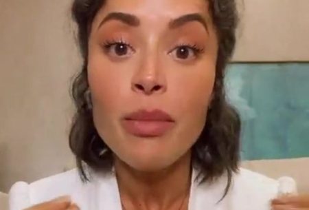 Aline Campos assusta ao sofrer acidente de moto em Bali e mostra ferimentos no corpo