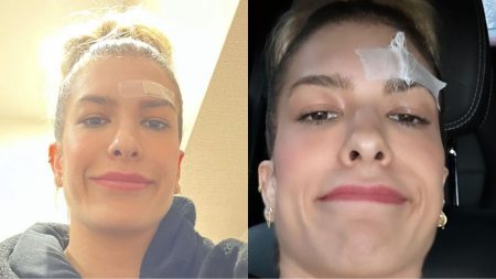 Lorena Improta passa por acidente e conta o que viveu: “Sangue para todo lado”