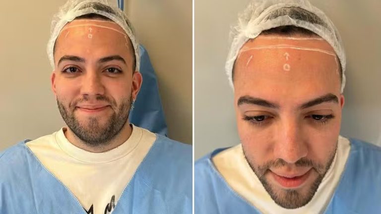 Lucas Rangel revela cirurgia