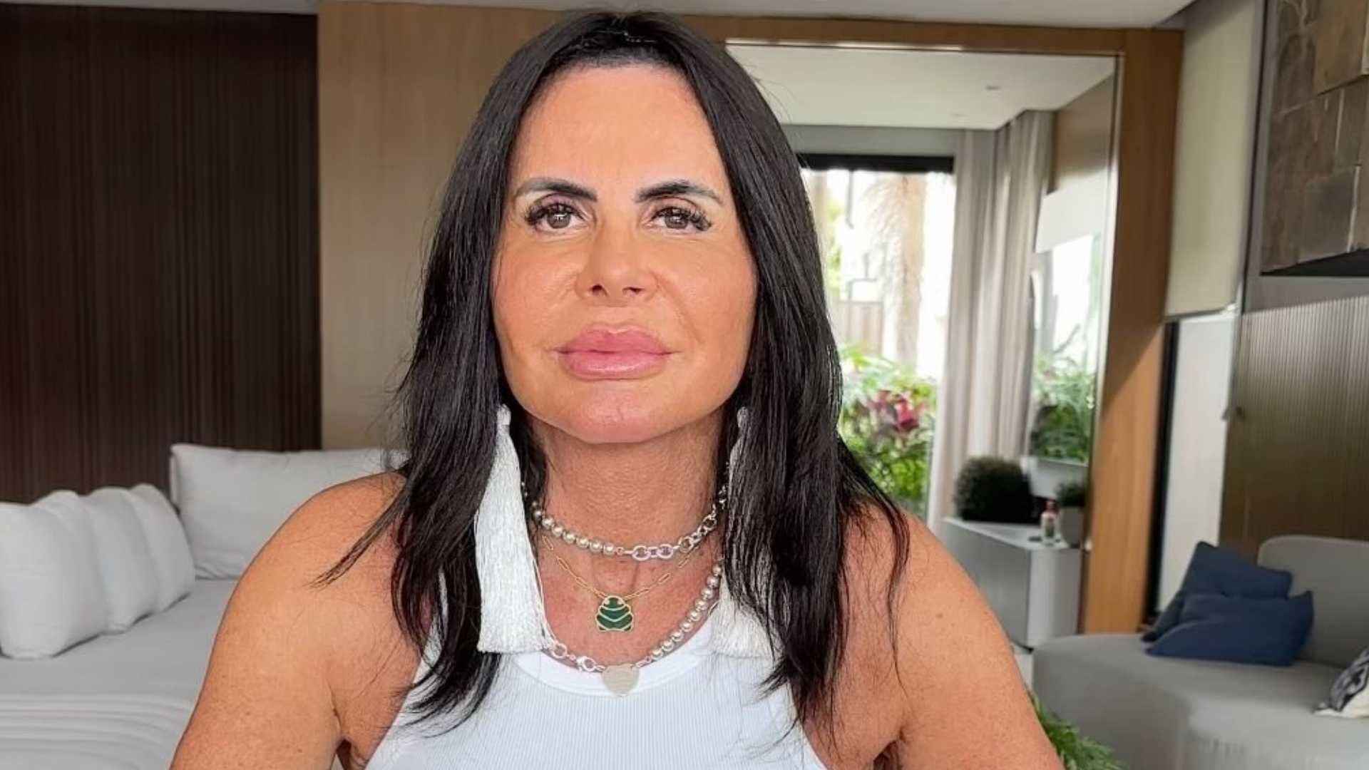 Gretchen surpreende com antes e depois de 5 anos fazendo procedimentos estéticos