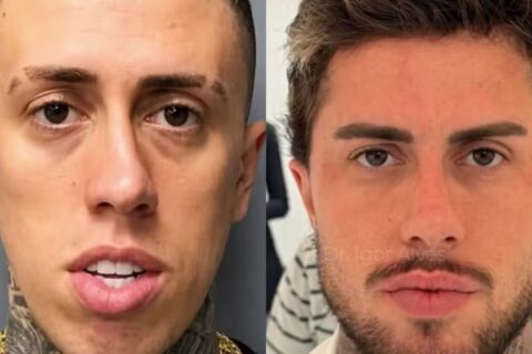 Antes ou depois? MC Daniel surge irreconhecível após série de procedimentos estéticos